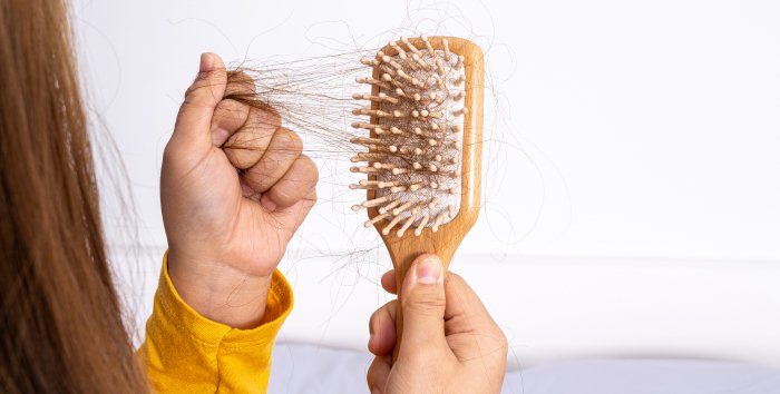 Top 5 des meilleurs traitements contre la chute des cheveux